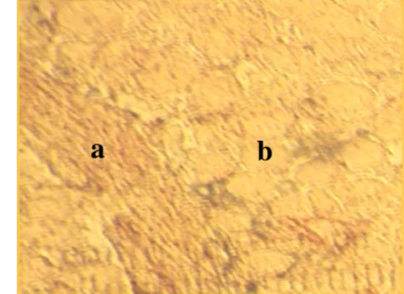 Gambar 2. Jaringan gonad pada ikan nila intesex  a. Bakal sel sperma; b. Bakal sel telur 
