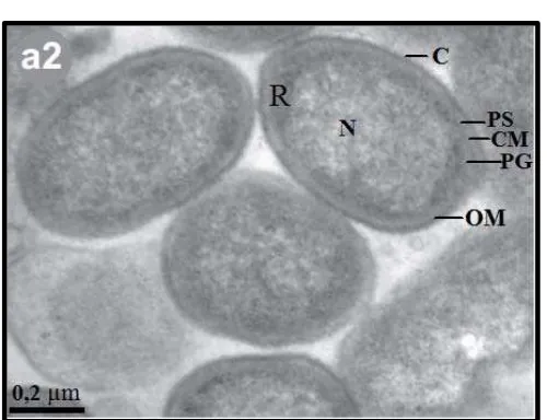 Gambar 4. Morfologi bakteri Porphyromonas gingivalispada gambaran TEM. R: Ribosomal, N: Nucleus, C: Capsule, PS: Periplasmic Space, CM: Cellluler Membrane, PG: Peptidoglycan, OM: Outer Membrane.40 