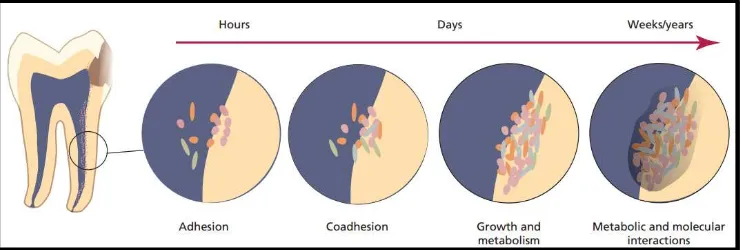 Gambar 3. Skema ilustrasi perkembangan biofilm pada saluran akar. Aderen dan koaderen mikroorganisme yang diikuti dengan pembelahan dan pertumbuhan yang bergantung pada nutrisi dari lingkungan.3 