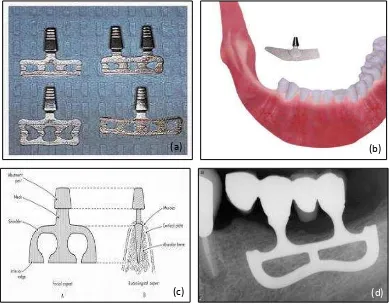 Gambar 4. Blade implant (a) Bentuk.35 (b) dan (c) Ilustrasi.37-8 (d) Radiografi.39  