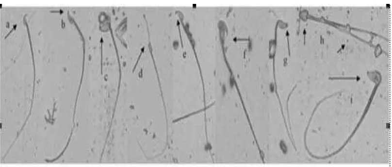 Gambar 2.4.2 Morfologi spermatozoa mencit. (a) spermatozoa normal, (b)  pengait salah membengkok, (c) sperma melipat, (d) kepala terjepit, (e) pengait pendek, (f) kesalahan ekor sebagai alat tambahan, (g) tidak ada pengait, (h) sperma berekor ganda dengan 
