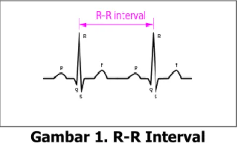 Gambar 1. R-R Interval 