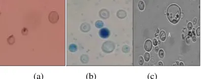 Gambar 2. Pengamatan mikroskopik isolat Saccharomyces, (a) dokumentasi pribadi, 2016; (b) Muhibuddin, 2015, Kurtzman dan Fell, 1998