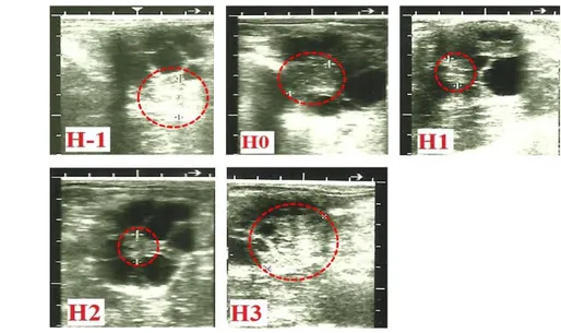 Gambar 4  Gambaran ultrasonografi perubahan korpus luteum (garis putus-putus). Pada hari  sebelum  pemberian  PGF 2α   (H-1)  korpus  luteum  bersifat  hyperechoic  dan  akan 