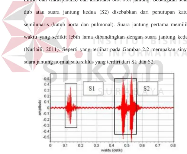 Gambar 2.2 Sinyal Suara Jantung Normal Satu Siklus (Puspasari dkk,  2012) 