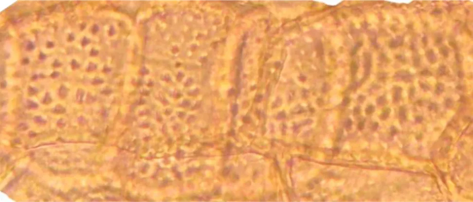 Gambar 1. Penampakan Kromosom K3 pada Perbesaran 17 x 40 