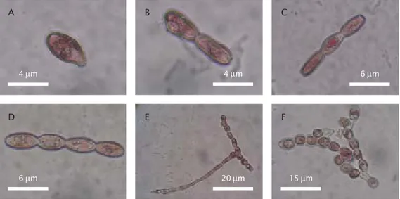 Gambar 6. Perkembangan sel embriogenik somatik K. alvarezii : (A) sel tunggal, (B) dua sel, (C) tiga sel, (D) empat sel, (E &amp; F) menjadi filamen