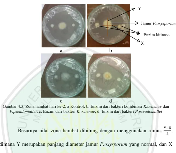 Gambar 4.3. Zona hambat hari ke-2. a Kontrol; b. Enzim dari bakteri kombinasi K.ozaenae dan  P.pseudomallei; c
