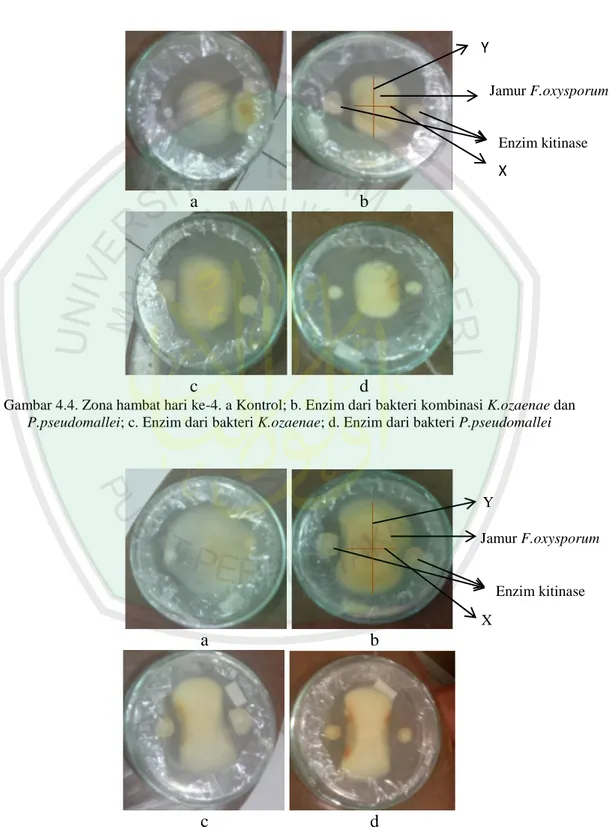 Gambar 4.4. Zona hambat hari ke-4. a Kontrol; b. Enzim dari bakteri kombinasi K.ozaenae dan  P.pseudomallei; c