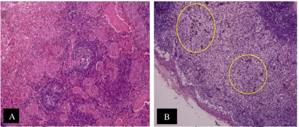Gambar 3. Gambaran histopatologi dengan menggunakan pewarnaan HE. (A)  Limpa,  tampak  perluasan  area  hemoragi;  dan  (B)  Limfonodus  inguinal  superfisial