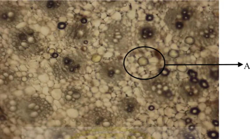Gambar 5.8 pengamatan dengan mikroskop perbesaran 100x dalam media kloralhidrat; A= sel sekresi berisi minyak atsiri.