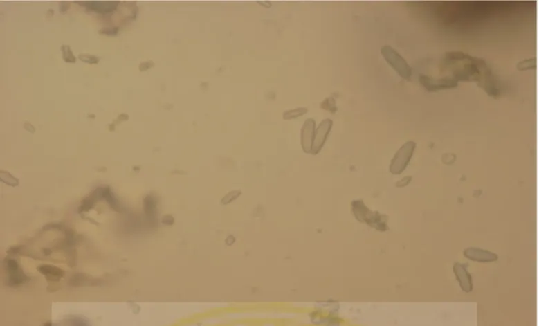 Gambar 5.13 butir amilum berbentuk lonjong dan bulat telur pada pengamatan dengan mikroskop perbesaran 400x dalam media air.