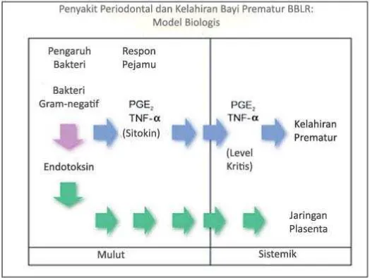 Gambar 2. Model biologis  dari penyakit periodontal dan bayi prematur BBLR 14 