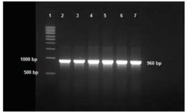 Gambar 6. Gel elektroforesis gen nitrilase bakteri  unggulan TPIK,GLB5  dan LP3  menggunakan  primer Nit1101F dan Nit1101R, dengan suhu  anneling optimum 60 0 C