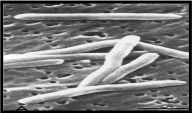 Gambar 1.  Koloni F.nucleatum                    dibawah Scanning  Electron Microscopy (SEM)8 