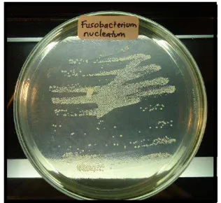 Gambar 10. Koloni bakteri F.nucleatum pada MHA 