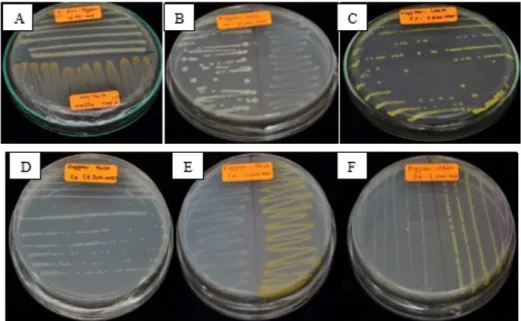 Gambar  2. Pertumbuhan Bakteri yang diisolasi dari sampel yang telah diperkaya dengan senyawa nitril   seperti  benzonitrile (A),  laktonitril (B,C), asetonitril (D), dan adiponitril  (E-F) (Bacterial growth  of  sampels  enriched  with  nitrile  compounds