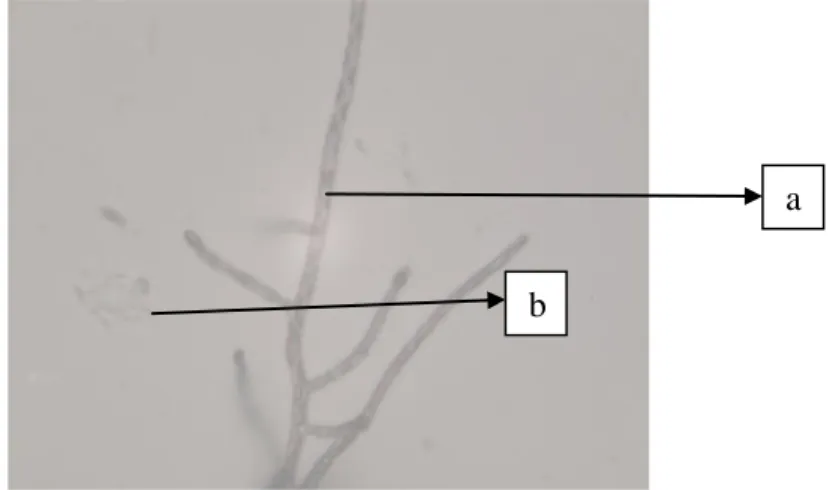 Gambar 4. Morfologi kapang pendegradasi amilum hasil isolat   C 22  dan C 23  (a = sporangiofor dan b = sporangium) 