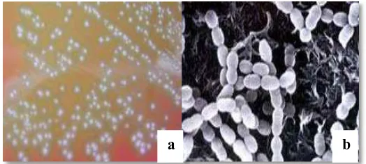 Gambar 2.1.a.  Koloni Streptococcus pada media agar darah (α-hemolysis) (Way et al., 2007) b