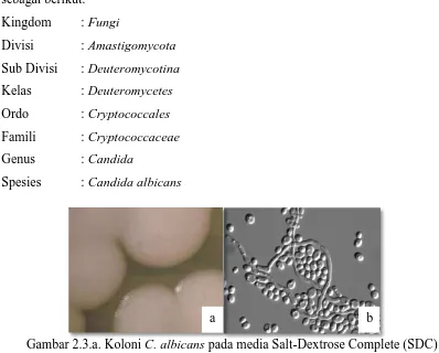 Gambar 2.3.a. Koloni C. albicans pada media Salt-Dextrose Complete (SDC) b. Sel C. albicans secara mikroskopis (Berman dan Peter, 2002) 
