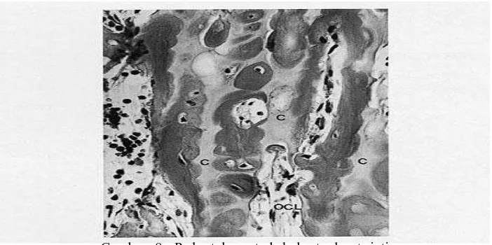 Gambar 8. Pada tulang trabekula terdapat inti kartilago (C) dan kerusakan osteoklas (OCL) dalam remodeling tulang.30 