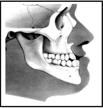 Gambar 2. Profil wajah, dental dan skeletal pada maloklusi Klas III.35 