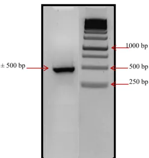 Gambar 3  Hasil amplifikasi genom ORSV pada bagian gen protein mantel dengan RT-PCR.  
