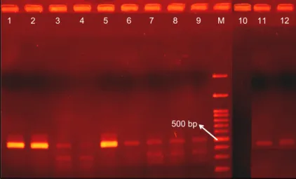 Gambar 7. Hasil uji RT-PCR sampel tebu pasca-perlakuan organogenesis (1–9) dan krioterapi (10–12)