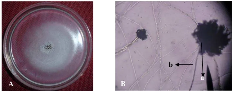 Gambar 3. Aspergillus sp. Koloni berumur 14 hari pada media PDA (A) dan bentuk mikroskopik (B), konidia (a), konidiofor (b) 