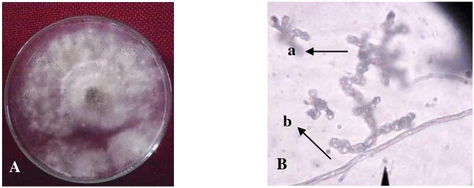 Gambar 4. Fusarium mikroskopik (B), konidia (a), fialid (b), konidiofor (c) sp. Koloni berumur 14 hari pada media PDA (A) dan bentuk B 