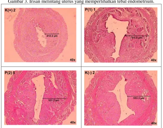 Gambar 3. Irisan melintang uterus yang memperlihatkan tebal endometrium. 