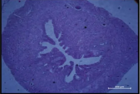 Gambar  di  atas,  menunjukkan  uterus  terdiri  atas  tiga  lapisan  penyusun,  yaitu  endometrium,  miometrium  dan  perimetrium