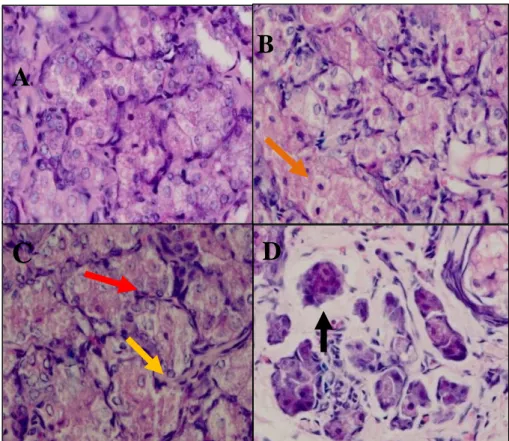 Gambar 3. Gambaran Histopatologi Kelenjar Payudara tikus SD Menggunakan Pewarnaan Hematoxylin- Hematoxylin-Eosin  yang  diberi  Oleum  Maydis  (A)  Ekstrak  Sambiloto  100  mg/kg  BB  (B)
