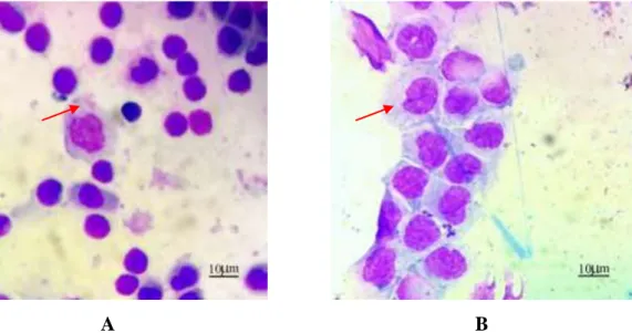 Gambar 1.  Gambaran  mikroskopis  sel  makrofag  yang  tidak  teratur  dan  adanya  tonjolan sitoplasma ditunjukan pada anak panah