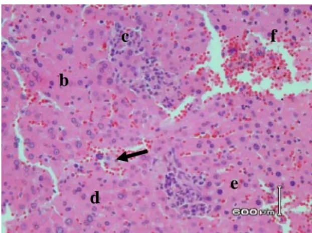 Gambar 3. Irisan melintang organ hati nekrosis dan kongesti mencit jantan kelompok IV                       (dosis 9,4185 g/kg BB) dengan perbesaran 400x dan pewarnaan hematoksilin-                      eosin 