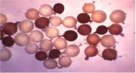 Gambar 4.Sista NSE (G. rostochiensis) (Sumber : IMP 1982) 