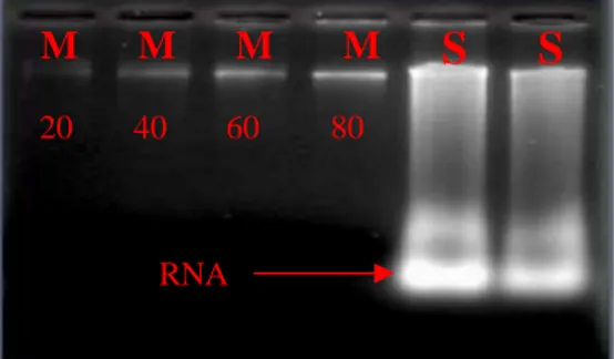 Gambar 4 Kontaminasi RNA pada DNA yang belum dimurnikan. M: marker DNA lambda konsentrasi dalam ng/µl, S: sampel.