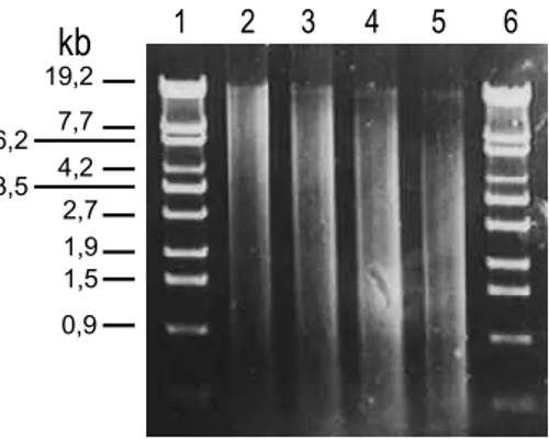 Gambar 2.  DNA total kedelai kultivar Lumut yang dipotong dengan berbagai konsentrasi 