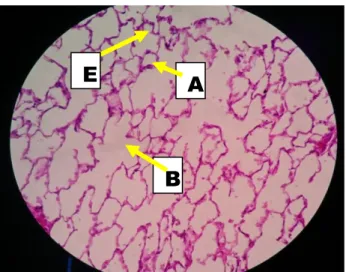 Gambar 5. Histologi alveolus kelompok gel (P1) (HE, 40x10) 