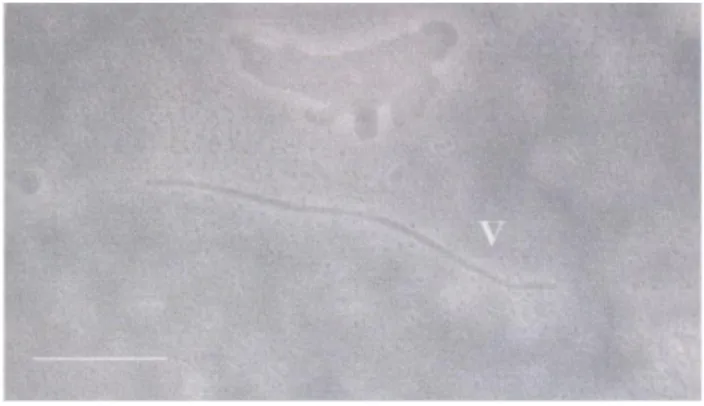 Gambar  4      Partikel  TuMV  (V)  yang  berasosiasi  dengan  penyakit  mosaik  pada  tanaman     caisin di daerah Cinangneng