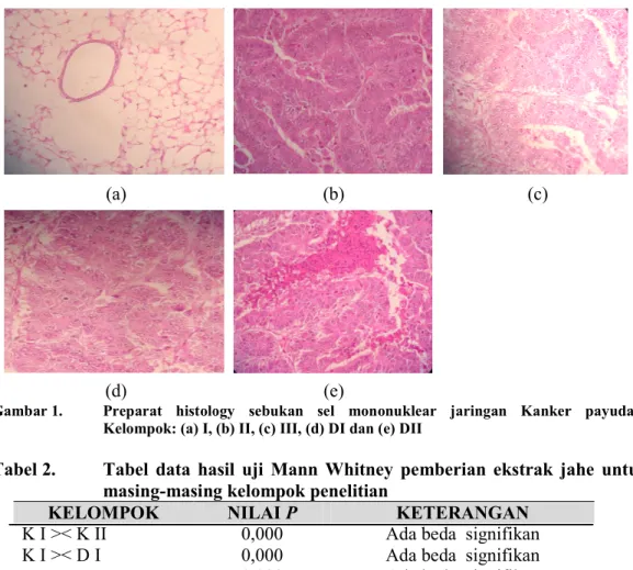 Gambar 1.   Preparat  histology  sebukan  sel  mononuklear  jaringan  Kanker  payudara  Kelompok: (a) I, (b) II, (c) III, (d) DI dan (e) DII