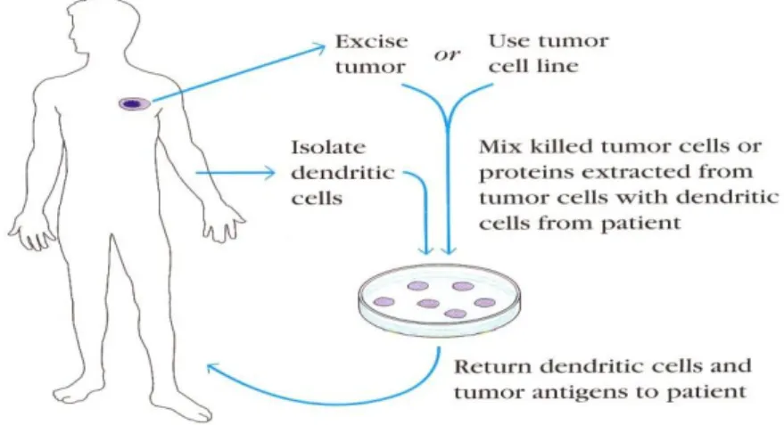 Gambar  7.  Vaksin kanker. Sel  tumor dikeluarkan dari  pasien  dan dimasukkan dalam  media klutur