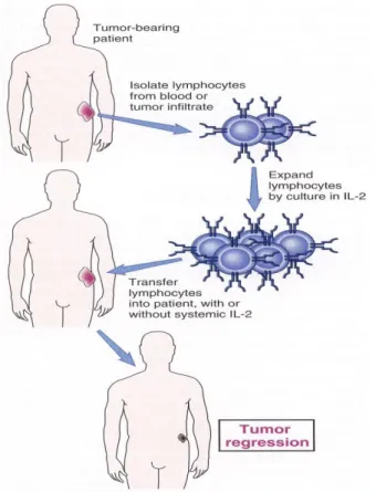 Gambar  3.  Terapi  seluler  adoptif.  Pada  terapi  ini,  limfosit  diisolasi  dari  darah  tumor  pasien, yang kemudian dikultur dengan IL-2
