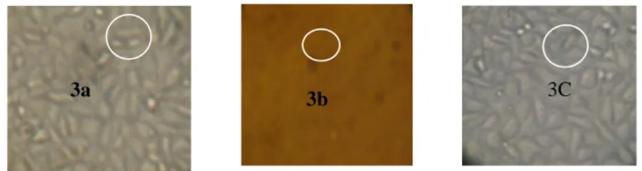 Gambar 3.  Efek Perlakuan Ekstrak Metanol Umbi Bit (Beta vulgaris L. var. rubra L.) Terhadap Cell  Line T47D dibandingkan dengan kontrol positif dan kontrol negatif 