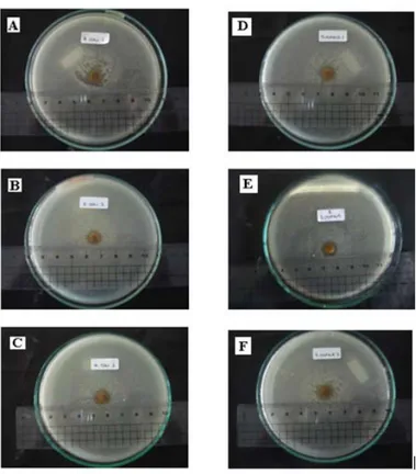 Gambar 1. Uji antibakteri ekstrak 100% Gracilaria sp terhadap E. coli dan S. aureus                      