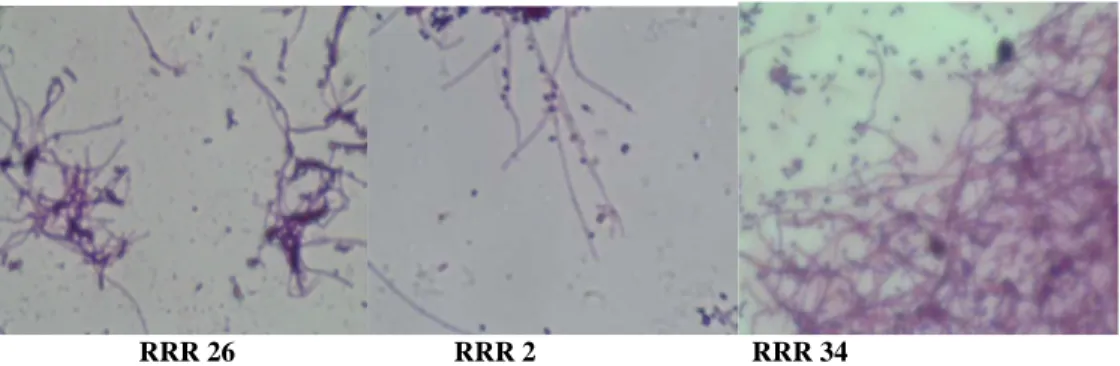 Gambar 1. Foto hasil pewarnaan Gram isolActinomycetes dari rizosfer rumput belulang (Eleusine indica  (L.) Geartn) yang berpotensi menghasilkan antibiotik