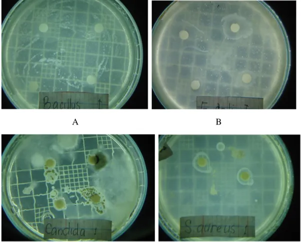 Gambar  6.  Hasil  uji  kemampuan  antimikroba  isolat  actinomycetes  AAR-1  terhadap  mikroba  uji  Bacillus  subtilis  (A),  E.coli (B), Candida albicans (C) dan  S
