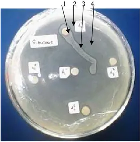 Tabel 1. hasil Penapisan Aktifitas Antibakteri  Isolat bakteri  spons  Hasil penapisan  aktifitas antibakteri  E coli  S aureus  A 11 -  -  A 12 -  -  A 13 -  -  A 14 -  -  A 15 -  -  A 21 -  -  A 22 -  -  A 23 +  +  A 24 -  -  A 25 -  +  Keterangan: 