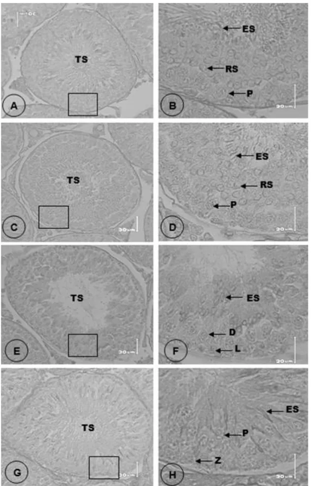 Gambar  2.  Profil  perkembangan  sel  spermatid.  A=  Tubulus  seminiferus  (TS)  stage  IV,  B=  Inset  A,  round  spermatid  (RS),  elongated  spermatid  (ES),  dan  pachyten  (P),  C=  Tubulus  seminiferus  (TS)  stage  VI