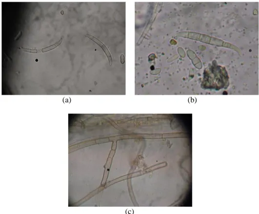 Gambar 3. Makrokonidia (a), Mikrokonidia (b) dan Hifa Fusarium sp. (c)  menghasilkan  tiga  jenis  spora  yaitu 